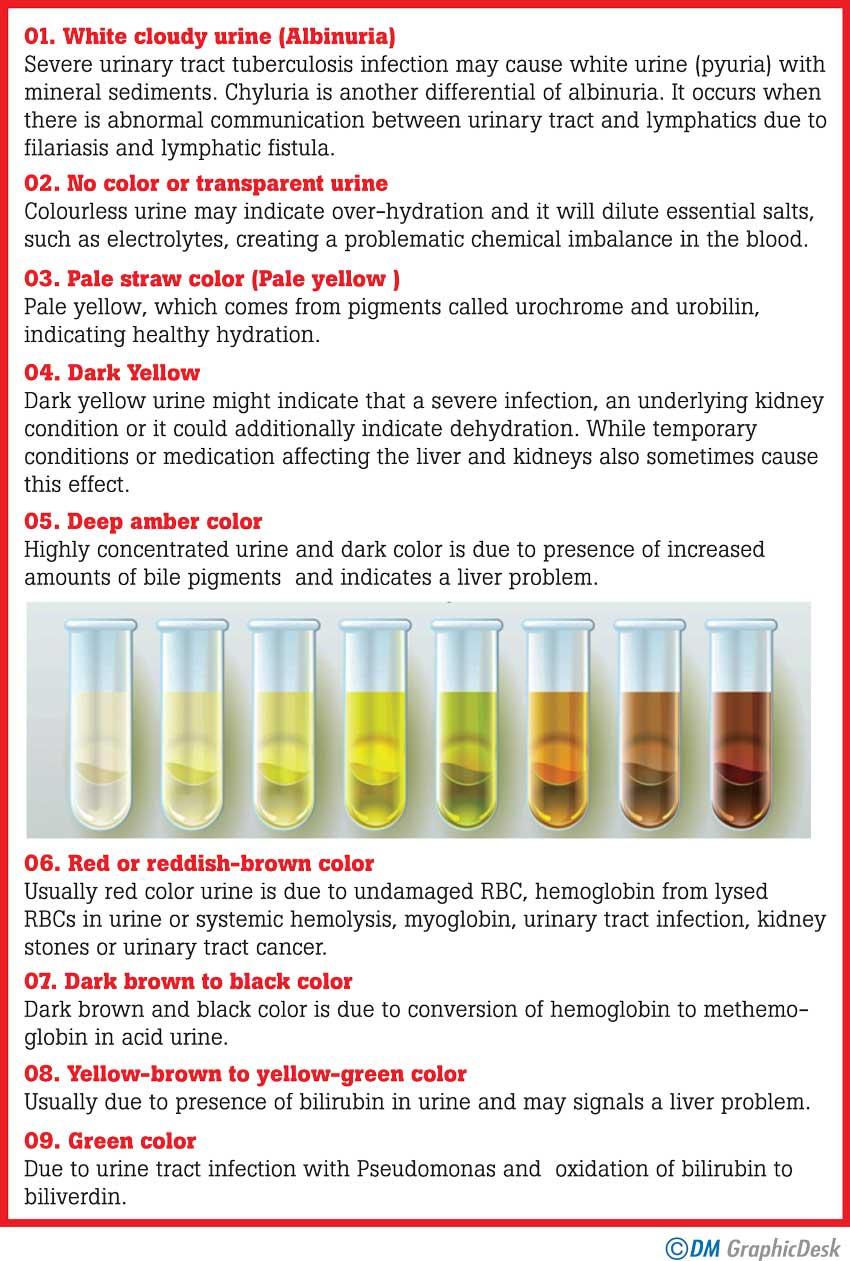 What does the colour of urine tell? - Medicine | Daily Mirror