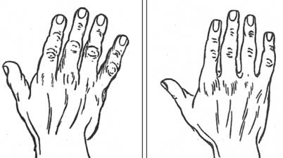 Judging character from the shape of the hand - Jyotisha News | Daily Mirror