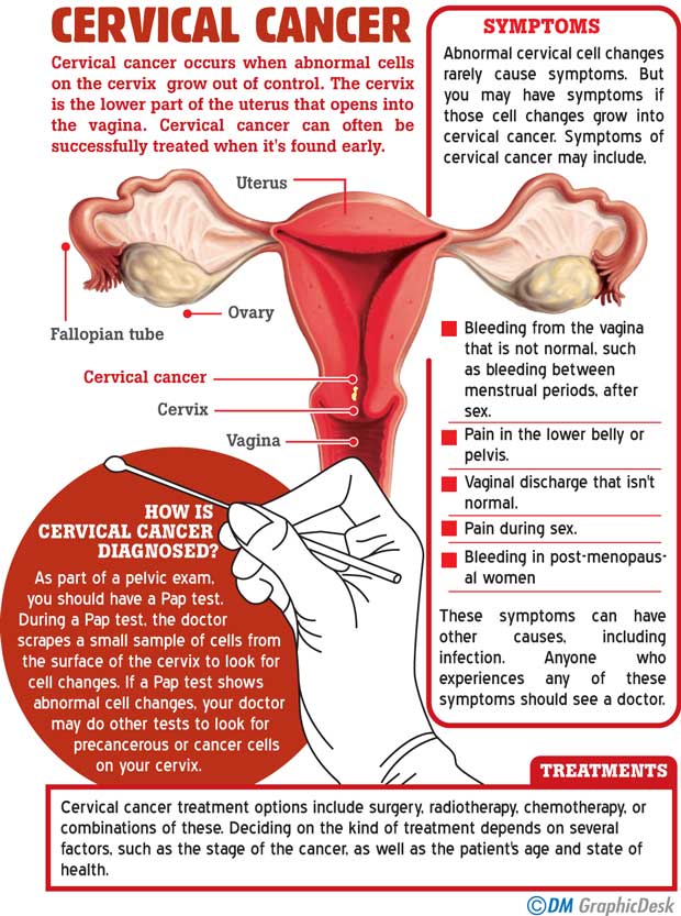 Cervical Cancer A Simple Screening Test Might Save Your Life Medicine