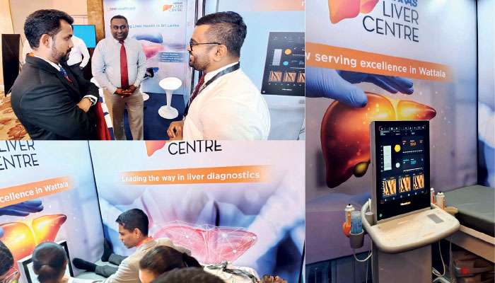 Hemas Hospital Wattala partners SLSG 2025, leading Sri Lanka in advanced liver care