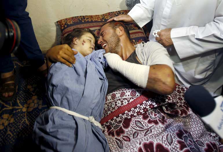 Wounded father of three-year-old Palestinian girl Rahaf Hassan who was killed with her mother hugs his daughter during her funeral in central Gaza Strip