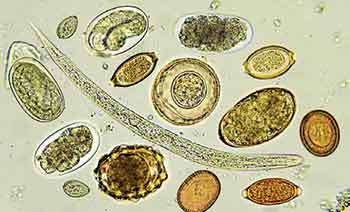 SEX එපා කියන සතා