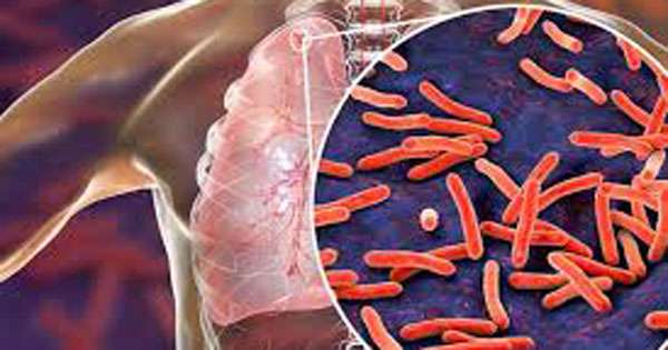 ක්ෂය රෝගීන් විශාල ප්‍රමාණයක් මහජනතාව අතර