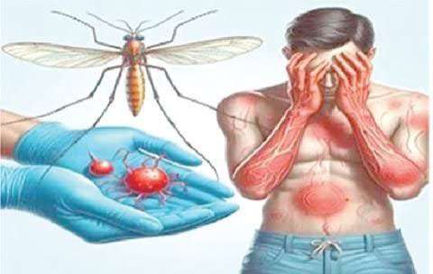 ඩෙංගු රෝගියෙක් ගෙදරදි බලාගන්න හැටි