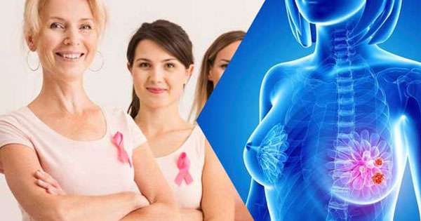 20න් පසු පියයුරු පරීක්ෂාවක් කර ගන්න