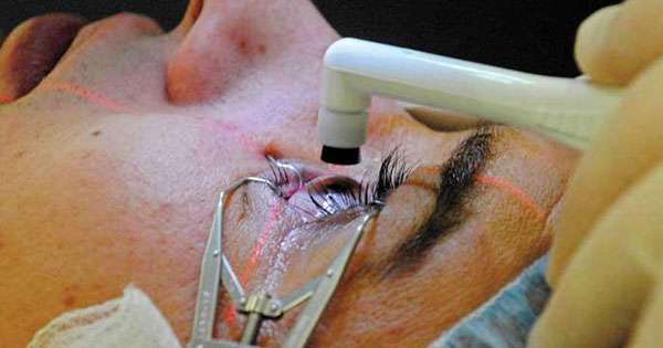 අක්ෂි කාච ගන්න ප්‍රසම්පාදනය දෙයි