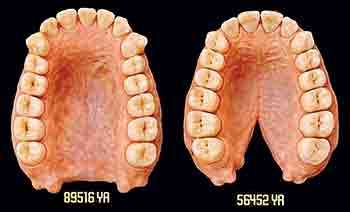 දත් සෙට්එකේ ‘ත්‍රස්තවාදියා’