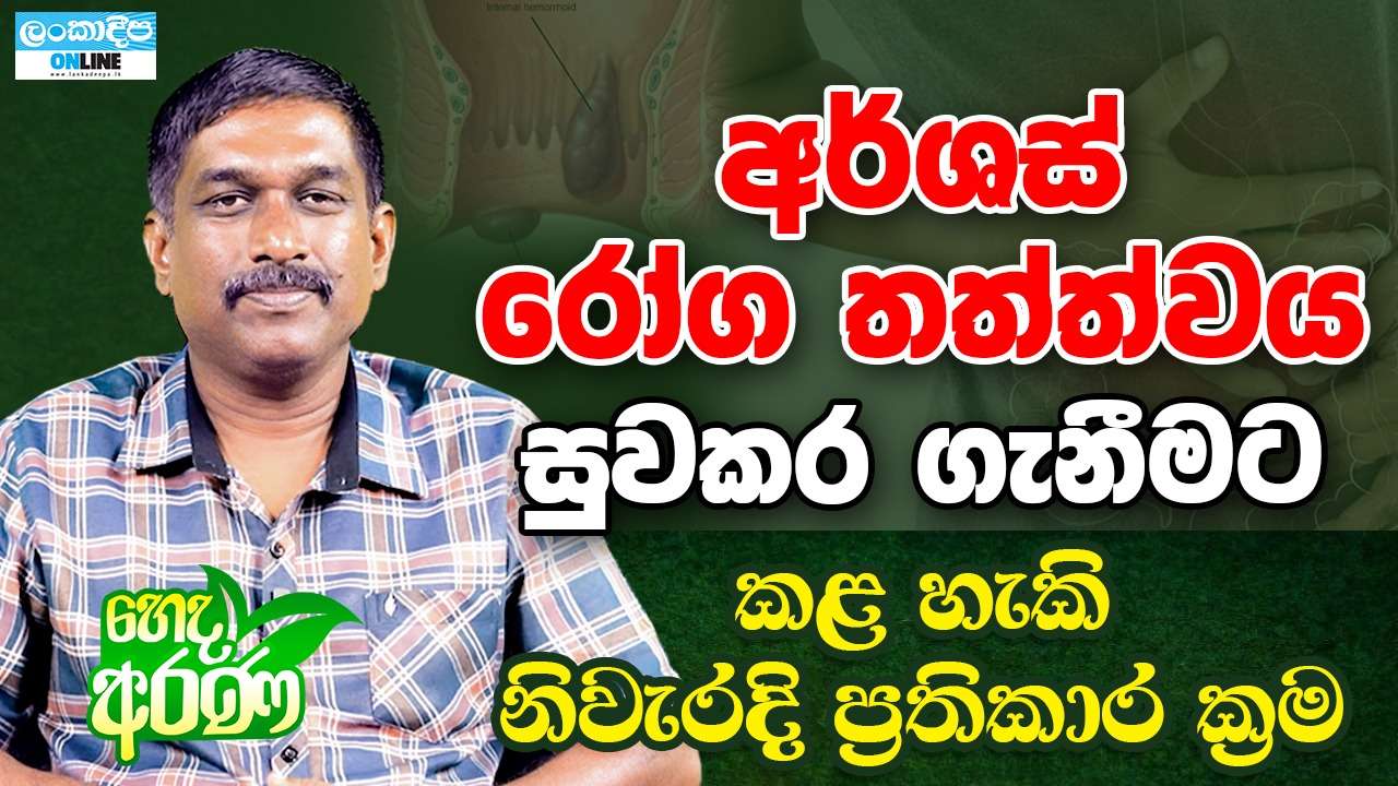 අර්ශස් රෝග තත්ත්වය  සුවකර ගැනීමට කළ හැකි නිවැරදි  ප්‍රතිකාර ක්‍රම