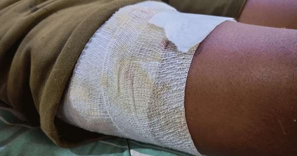 වනජීවි නියාමකට වල් ඌරු ප්‍රහාරයක්