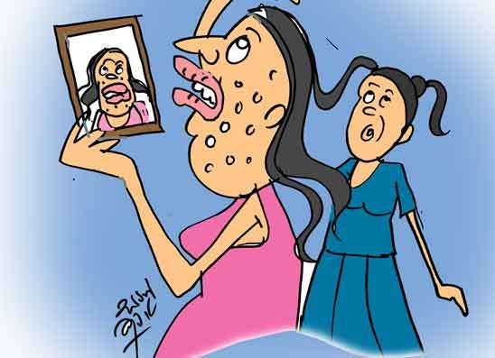 කොණ්ඩය කලු කරන්න ගිහින් අලි අමාරුවක
