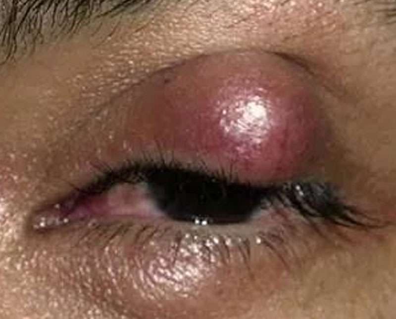 හිතටත් ගතටත් වද දෙන නඟන