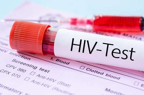 ලොව HIV වැඩිම රටවල් අතරට ශ්‍රී ලංකාවත්